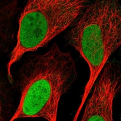 RNMT Antibody, Novus Biologicals 0.1mL; Unlabeled:Antibodies, Polyclonal